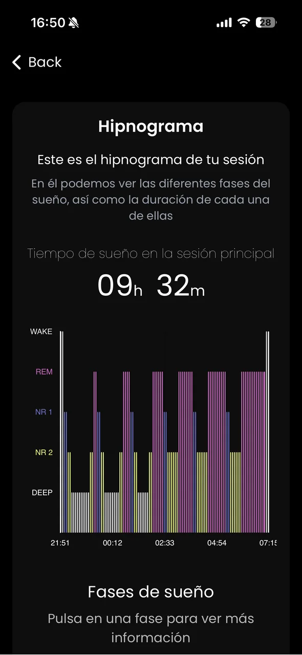 Hipnograma: representación de las fases del sueño hora a hora